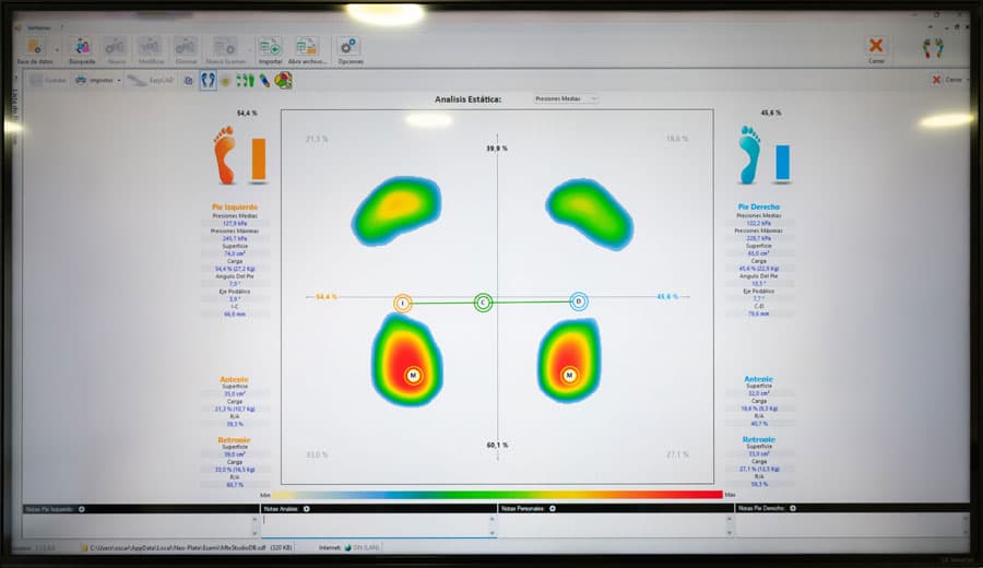 Estudio biomecánico pisada en Boiro
